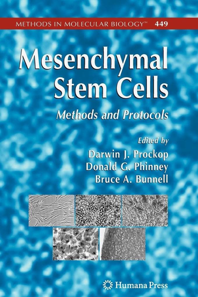 Mesenchymal Stem Cells