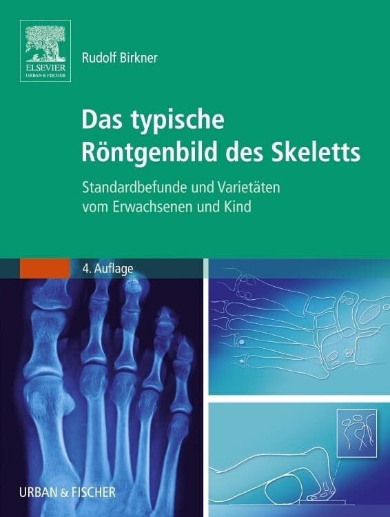Das typische Röntgenbild des Skeletts