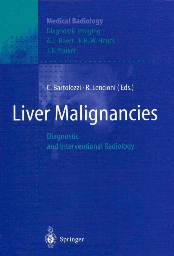 Liver Malignancies