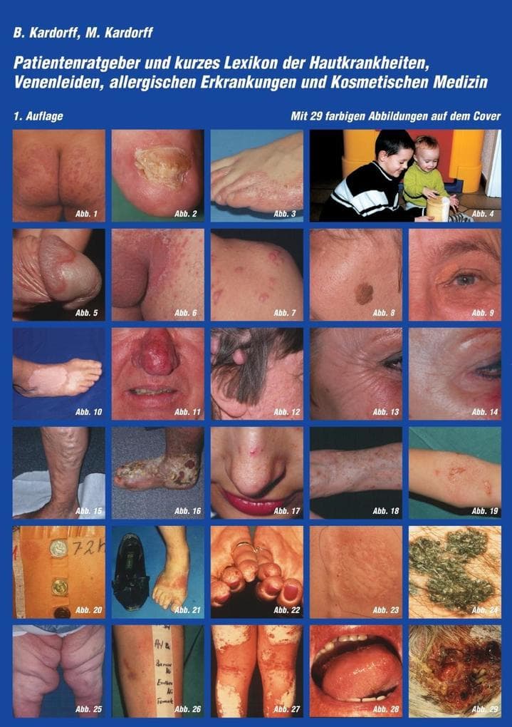 Patientenratgeber und kurzes Lexikon der Hautkrankheiten, Venenleiden, allergischen Erkrankungen und kosmetischen Medizin
