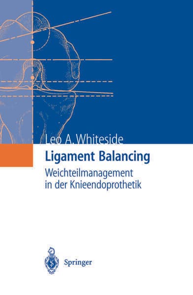 Ligament Balancing