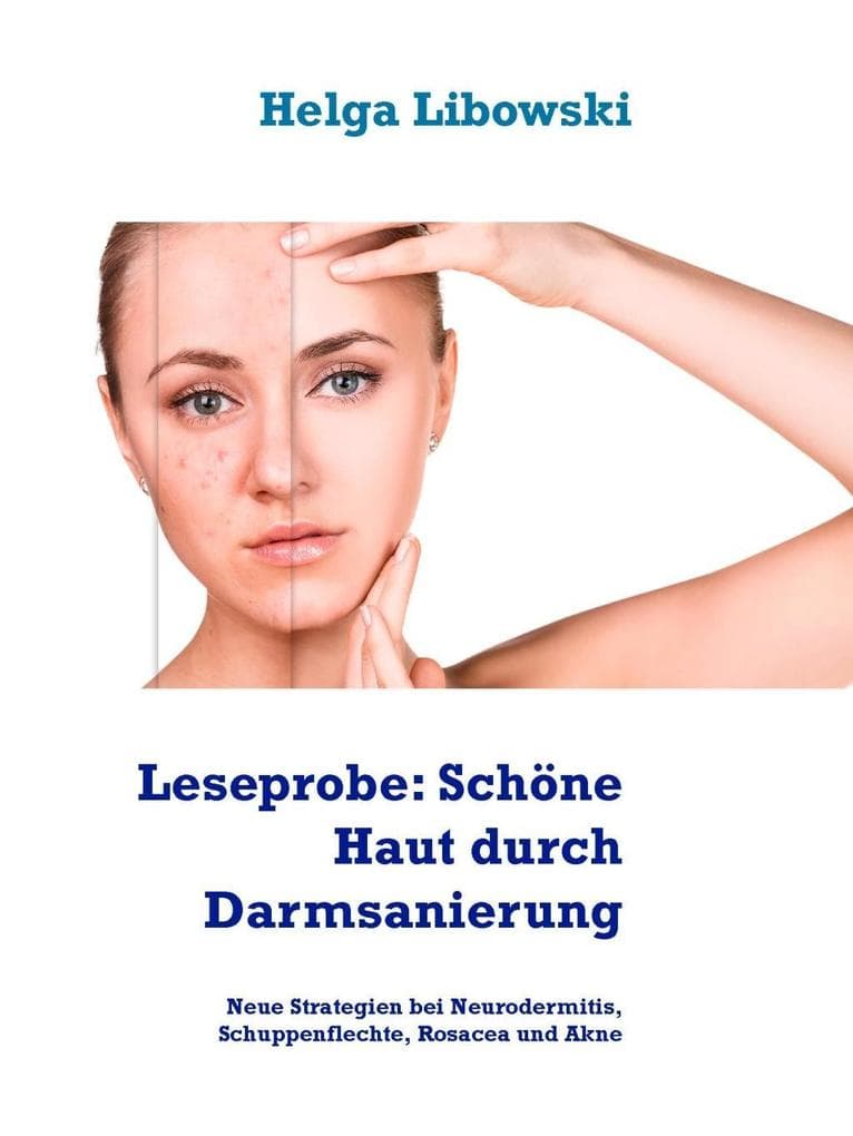 Leseprobe: Schöne Haut durch Darmsanierung