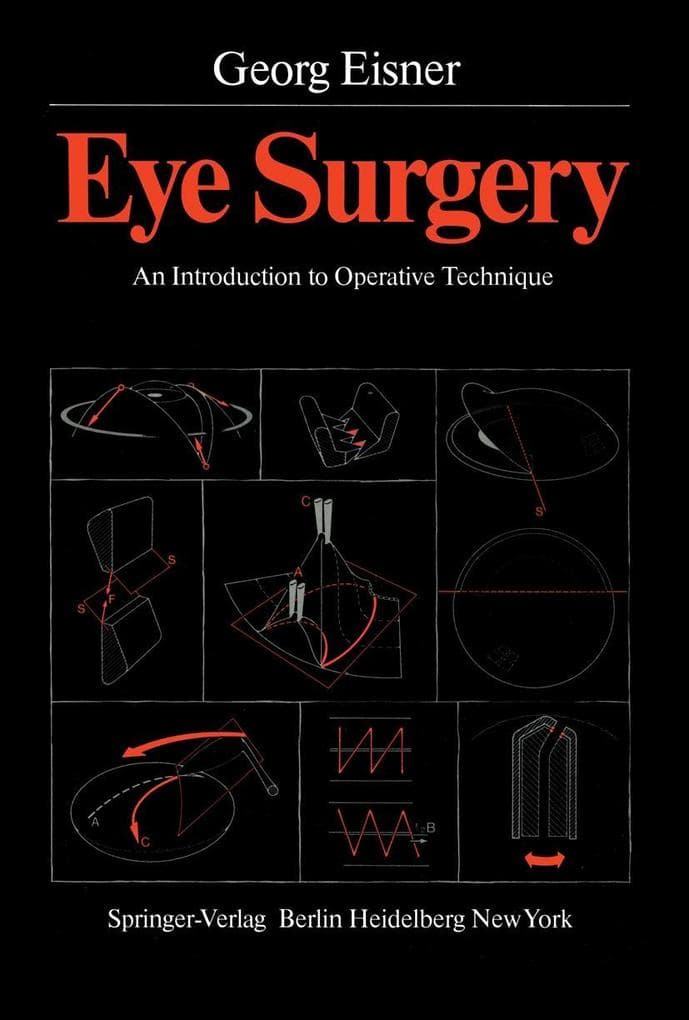 Eye Surgery