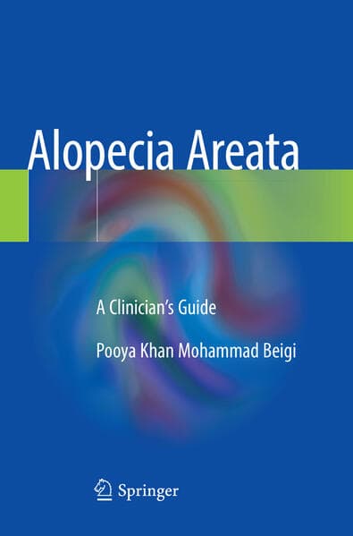 Alopecia Areata