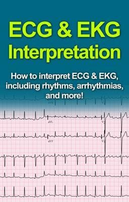 ECG & EKG Interpretation