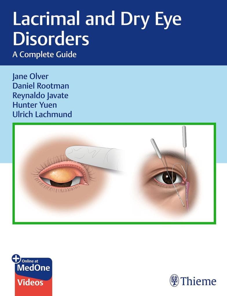 Lacrimal and Dry Eye Disorders