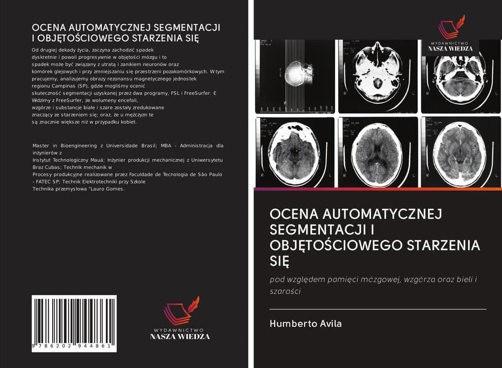 OCENA AUTOMATYCZNEJ SEGMENTACJI I OBJTOCIOWEGO STARZENIA SI