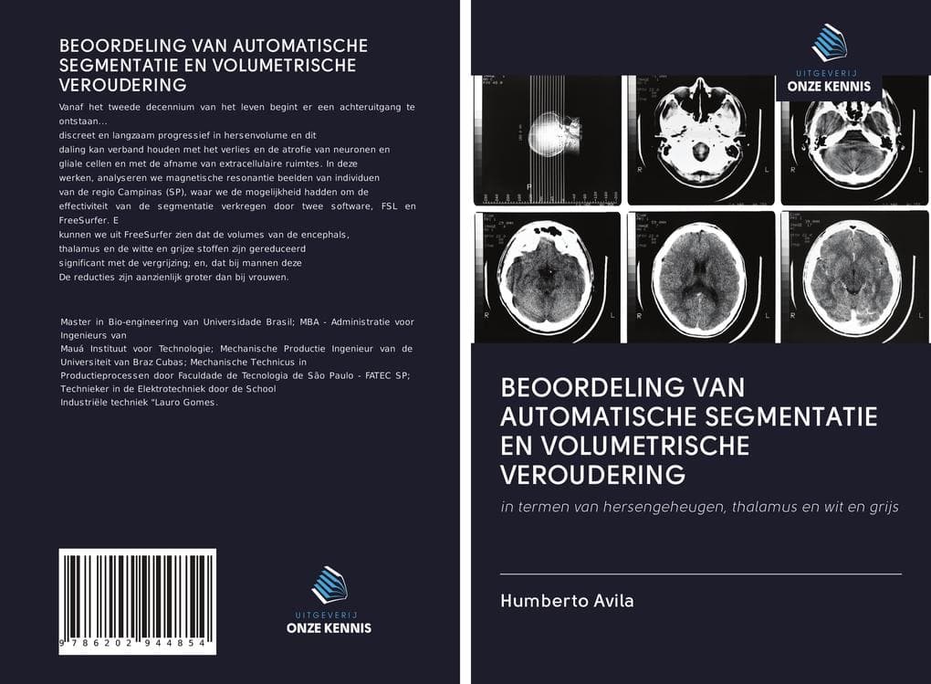 BEOORDELING VAN AUTOMATISCHE SEGMENTATIE EN VOLUMETRISCHE VEROUDERING