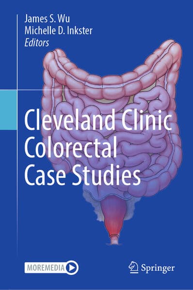Cleveland Clinic Colorectal Case Studies