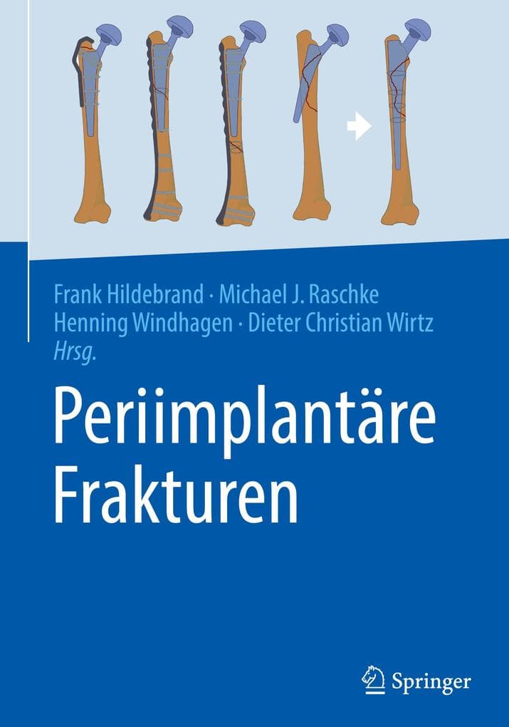 Periimplantäre Frakturen