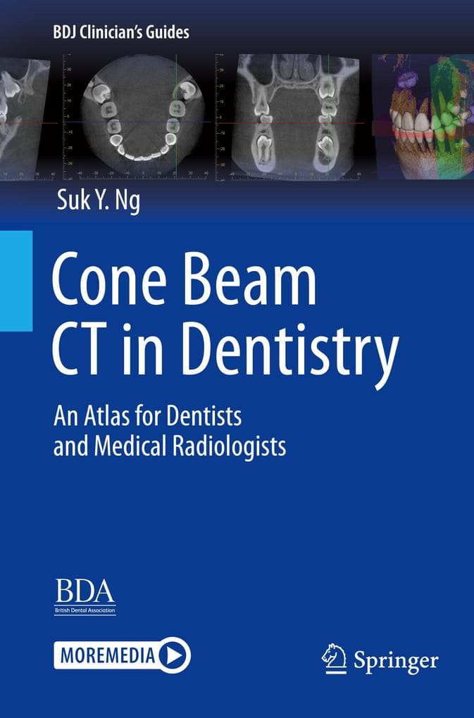 Cone Beam CT in Dentistry