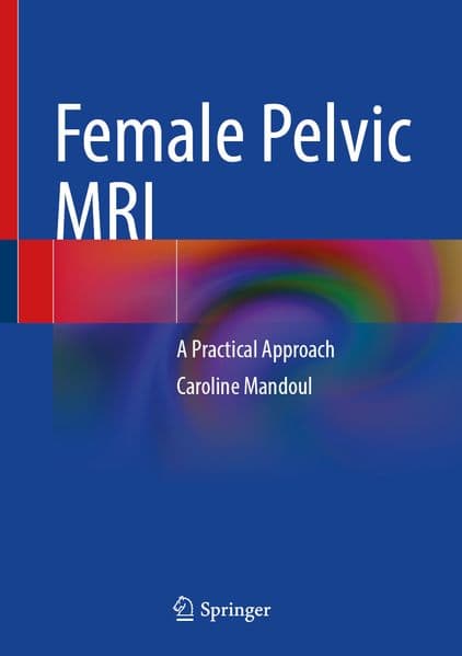 Female Pelvic MRI