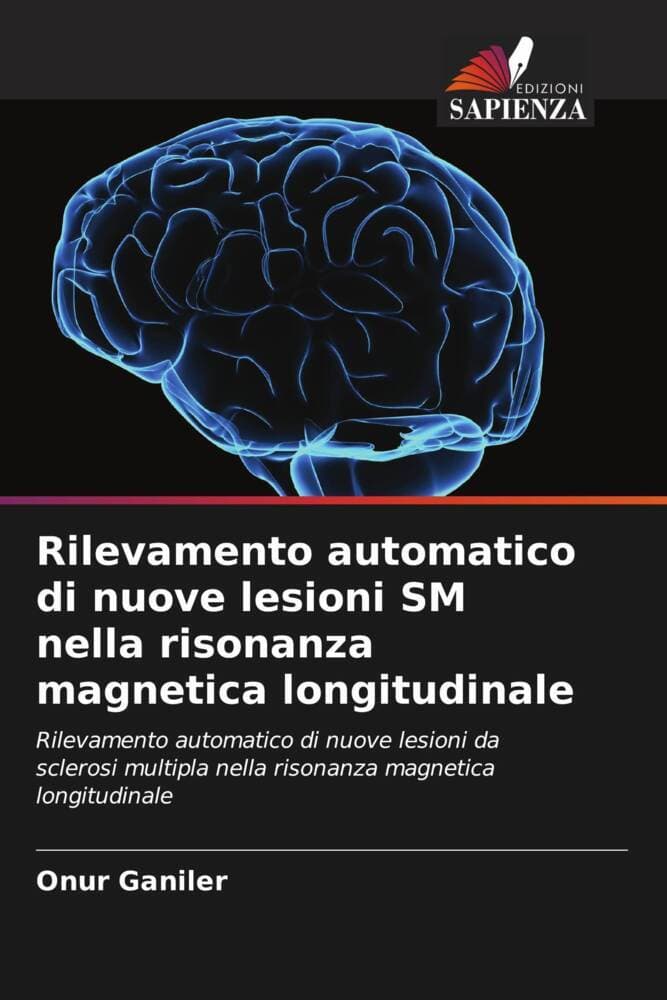 Rilevamento automatico di nuove lesioni SM nella risonanza magnetica longitudinale
