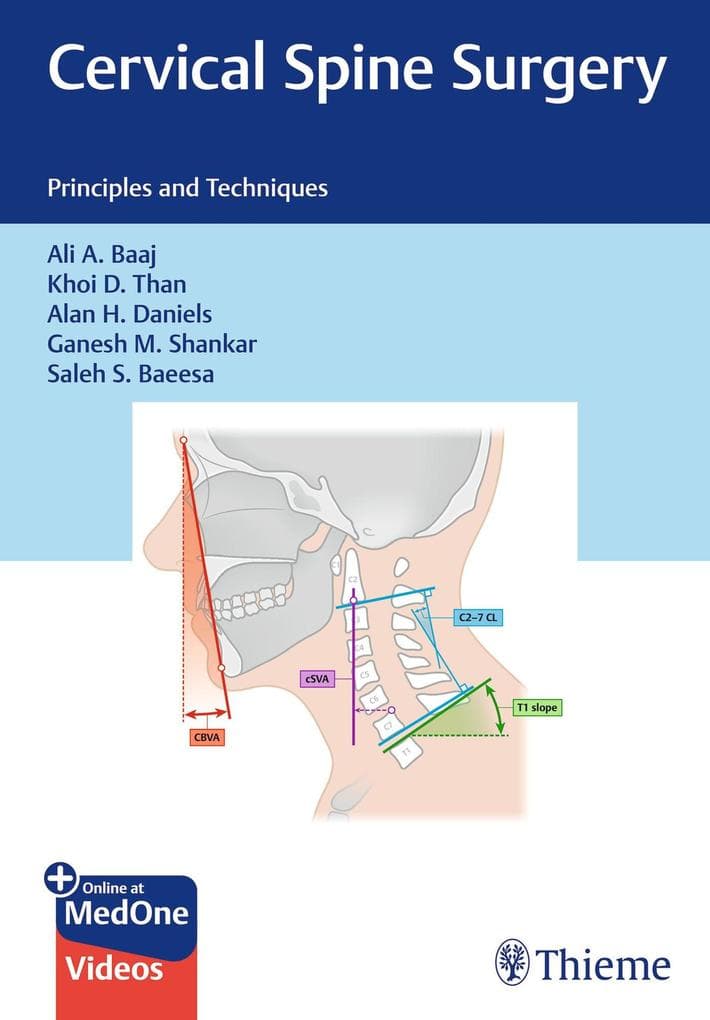 Cervical Spine Surgery