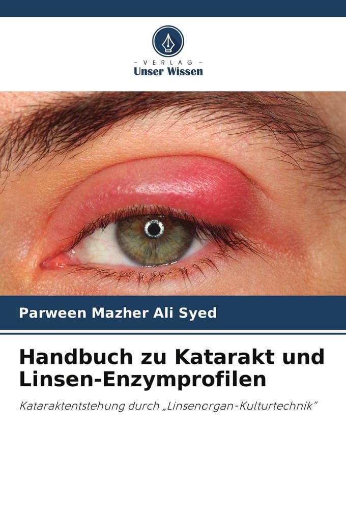 Handbuch zu Katarakt und Linsen-Enzymprofilen