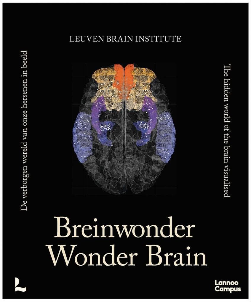Wonder Brain