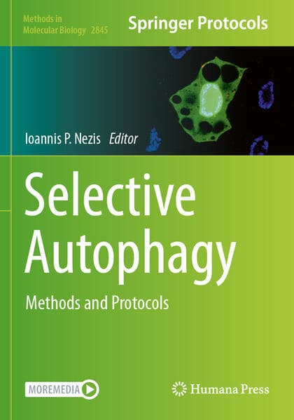 Selective Autophagy