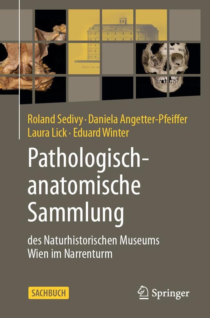 Pathologisch-anatomische Sammlung des Naturhistorischen Museums Wien im Narrenturm