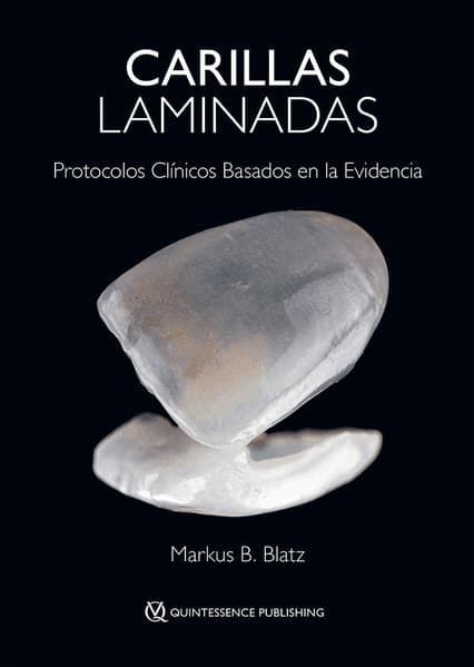 Carillas Laminadas
