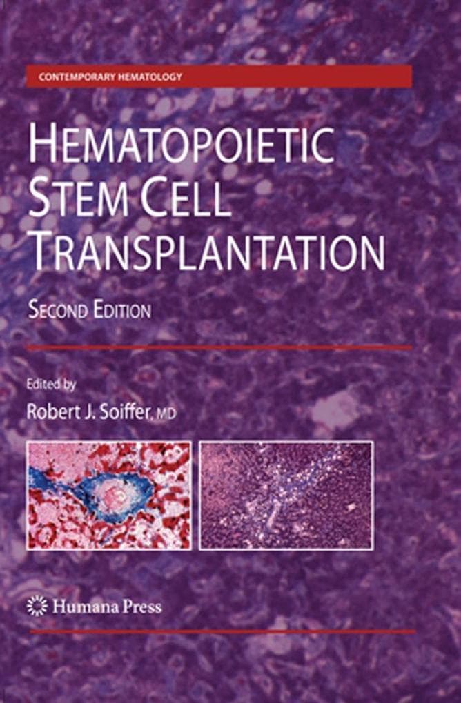 Hematopoietic Stem Cell Transplantation