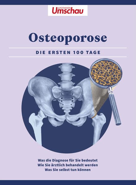 Apotheken Umschau: Osteoporose: Die ersten 100 Tage. Was die Diagnose bedeutet - Wie Sie ärztlich behandelt werden - Was Sie selbst tun können