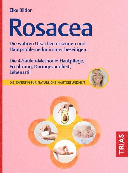 Rosacea: Die wahren Ursachen erkennen und Hautprobleme für immer beseitigen. Die 4-Säulen-Methode: Hautpflege, Ernährung, Darmgesundheit, Lebensstil