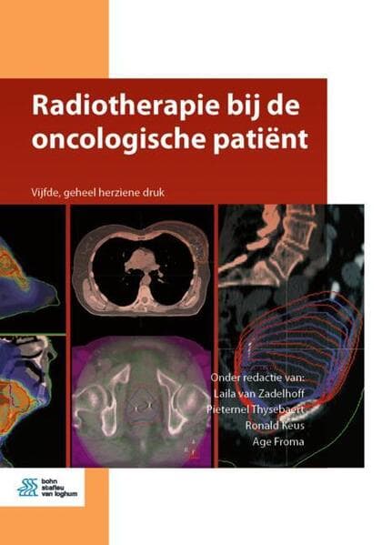 Radiotherapie bij de oncologische patiënt