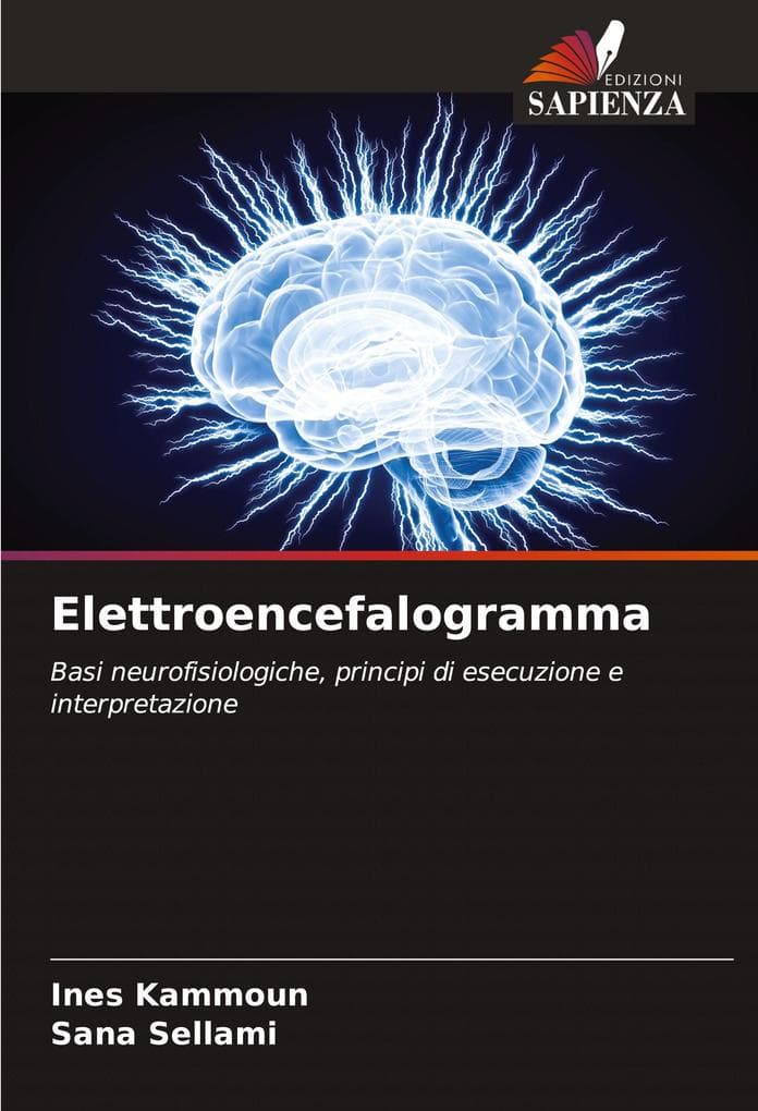 Elettroencefalogramma