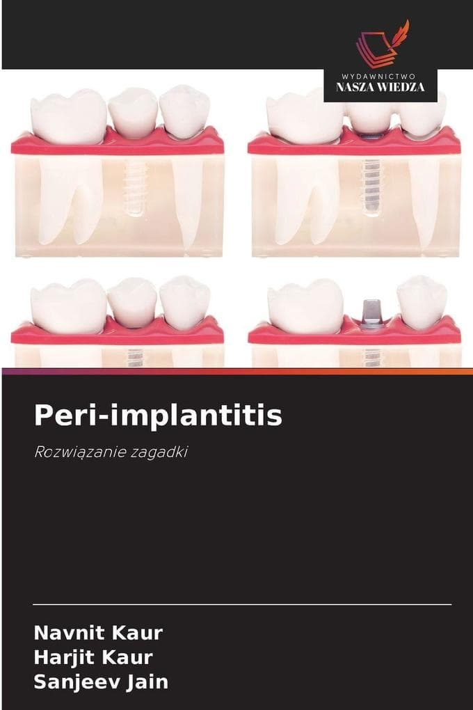 Peri-implantitis