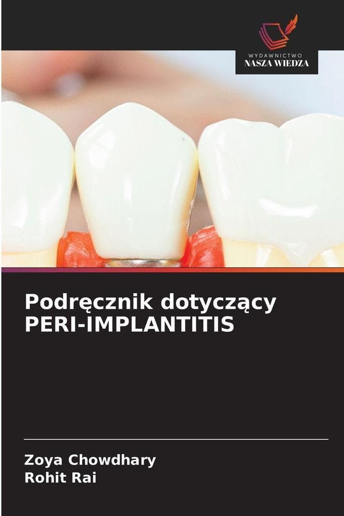 Podrcznik dotyczcy PERI-IMPLANTITIS