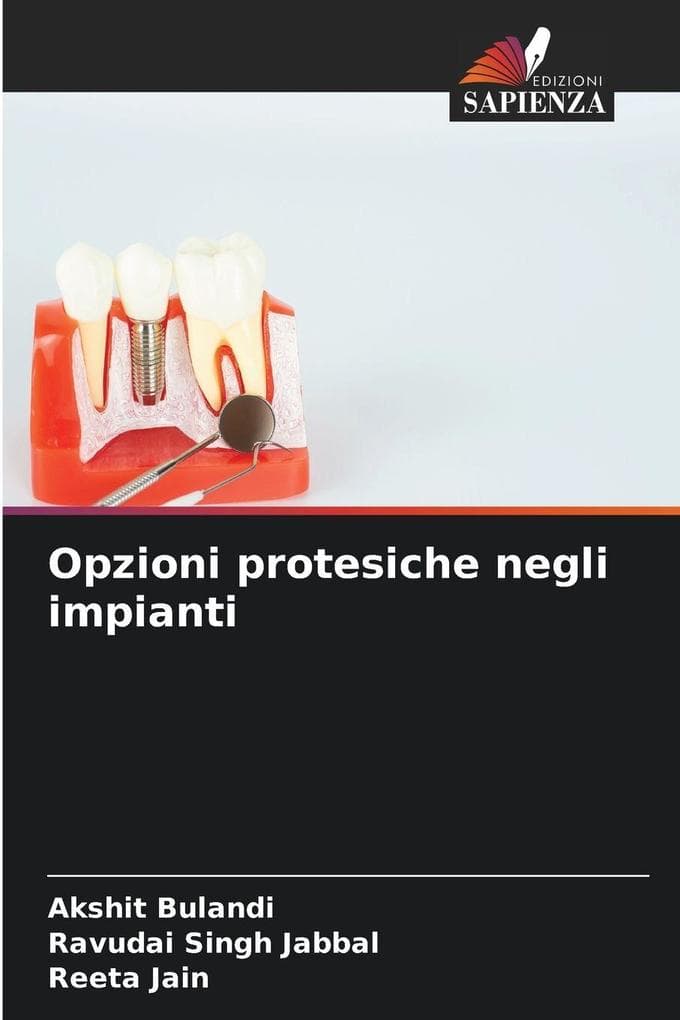 Opzioni protesiche negli impianti