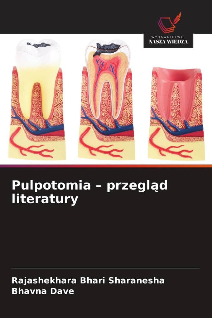 Pulpotomia - przegld literatury