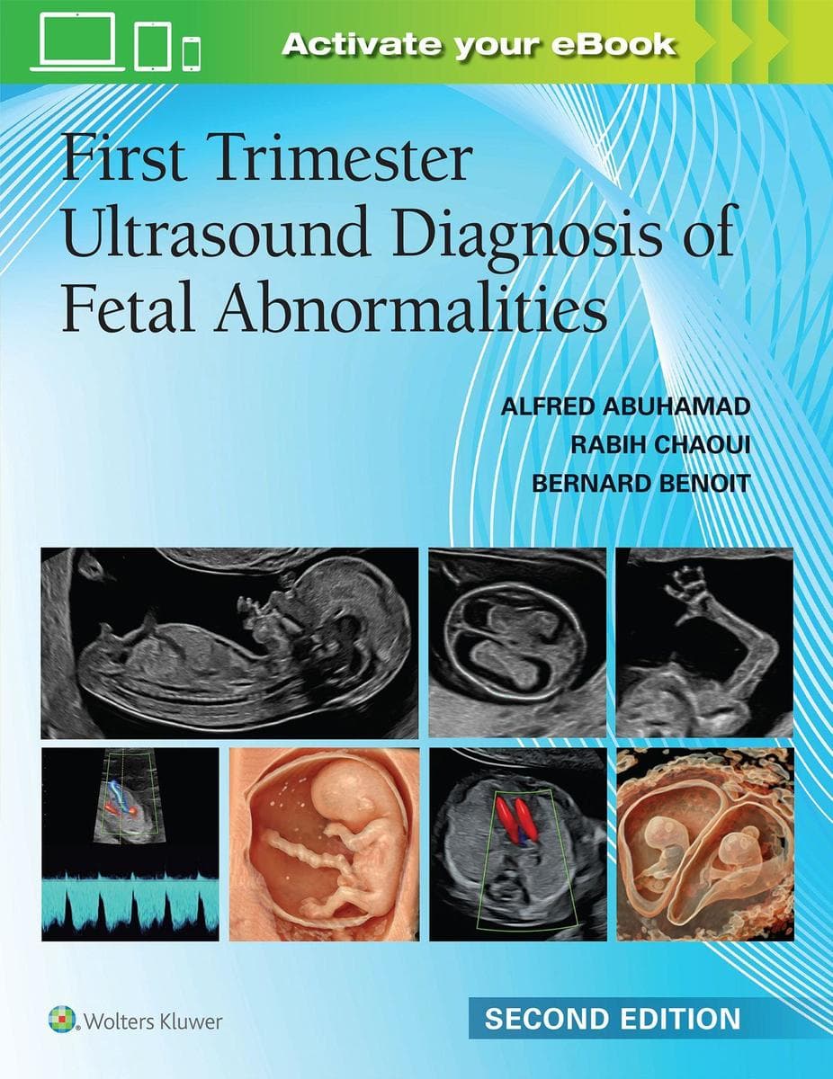 First Trimester Ultrasound Diagnosis of Fetal Abnormalities