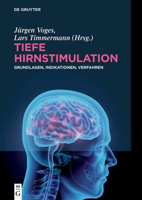 Tiefe Hirnstimulation: Grundlagen, Indikationen, Verfahren